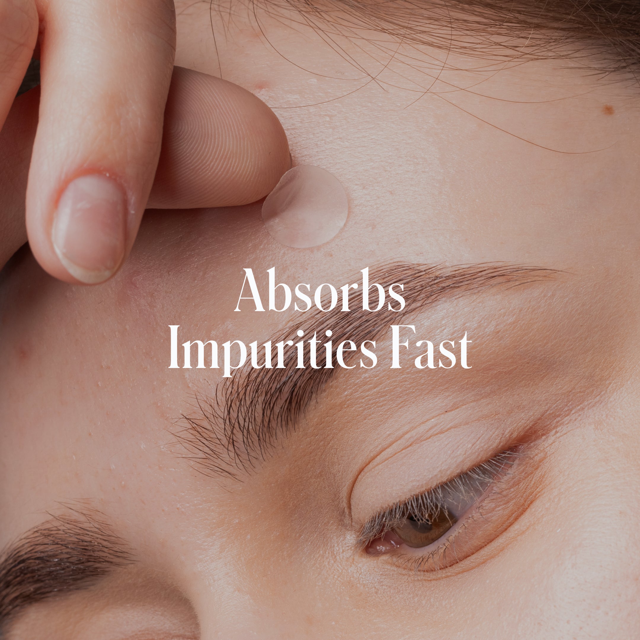 A close-up of a person applying the Geologie Anti Pimple Pack to their forehead, with the text Absorbs Impurities Fast overlaid on the image.